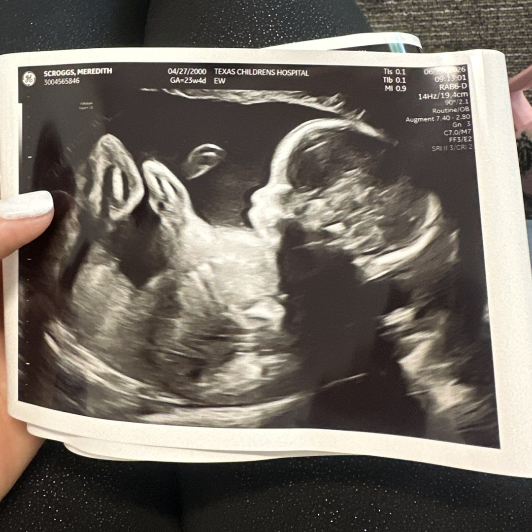 Photo shared by Meredith for their Babylist baby registry.