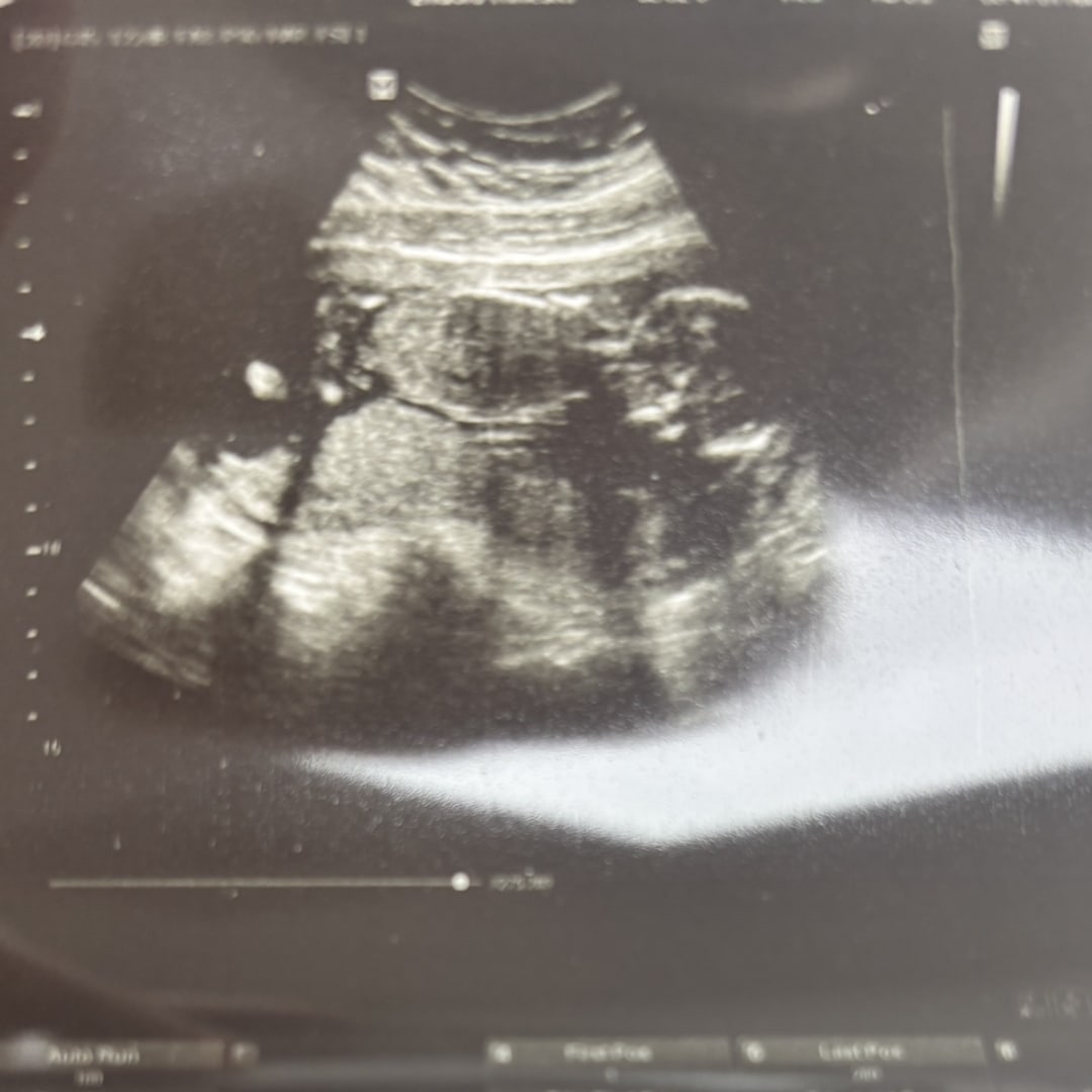 Photo shared by Eva for their Babylist baby registry.