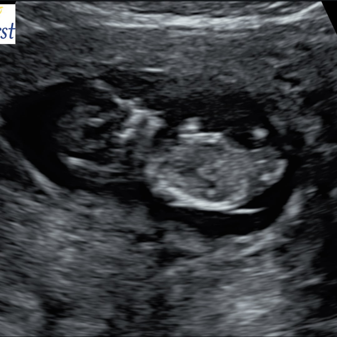 Photo shared by Antoniece for their Babylist baby registry.
