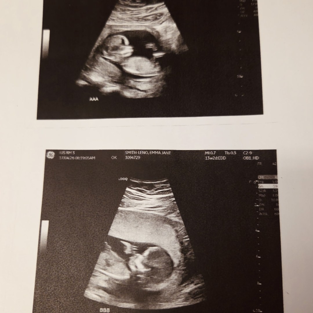 Photo shared by Alex for their Babylist baby registry.