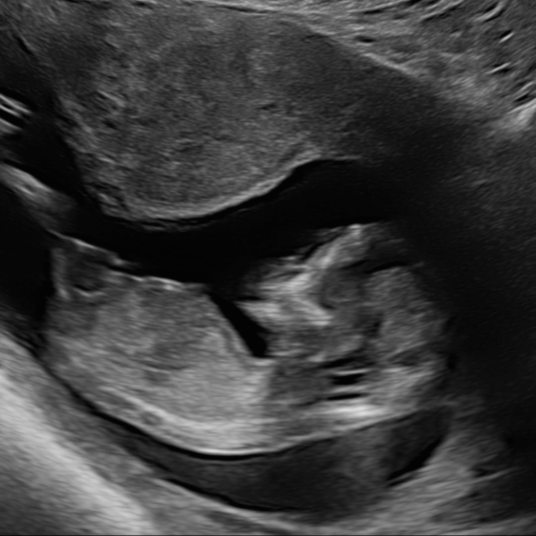 Photo shared by Allison for their Babylist baby registry.