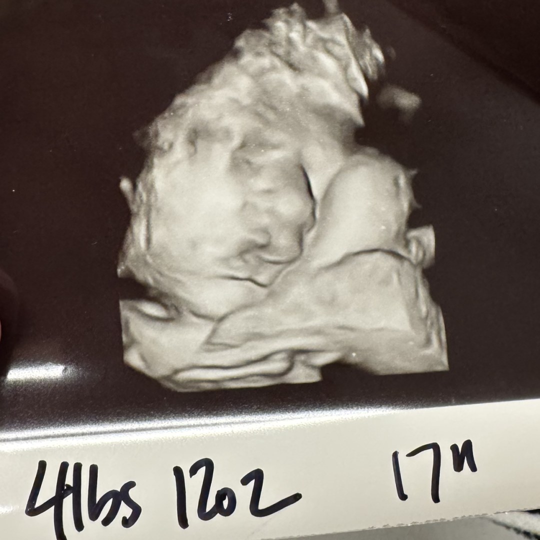 Photo shared by Destinee for their Babylist baby registry.