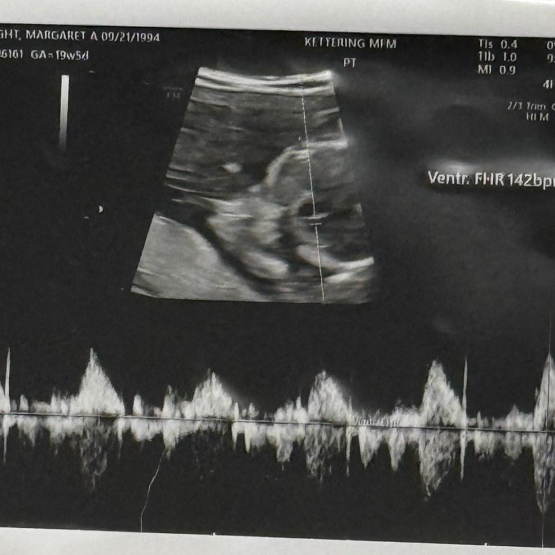 Photo shared by Maggie for their Babylist baby registry.