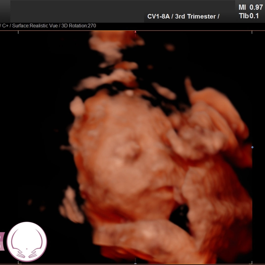 Photo shared by Susie & David for their Babylist baby registry.