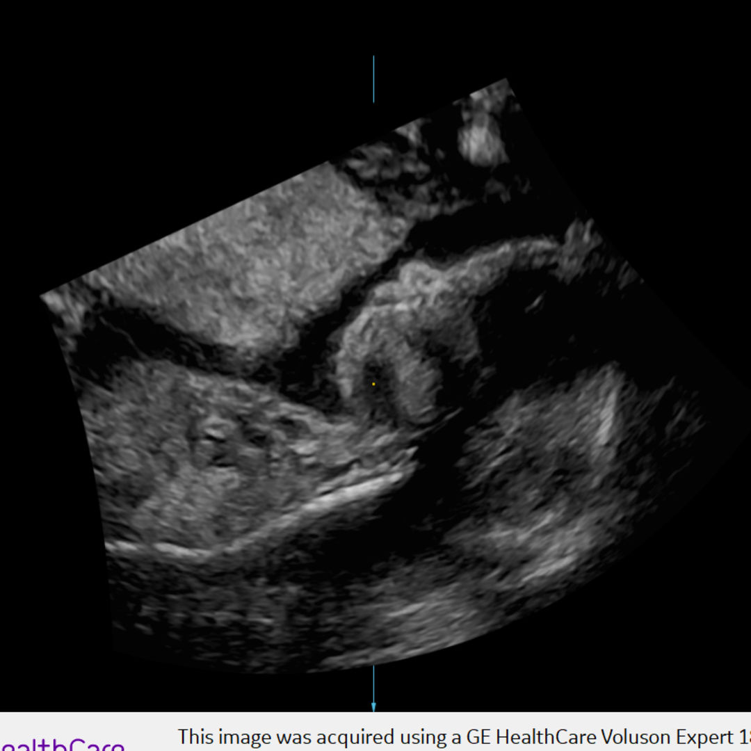 Photo shared by Anna for their Babylist baby registry.