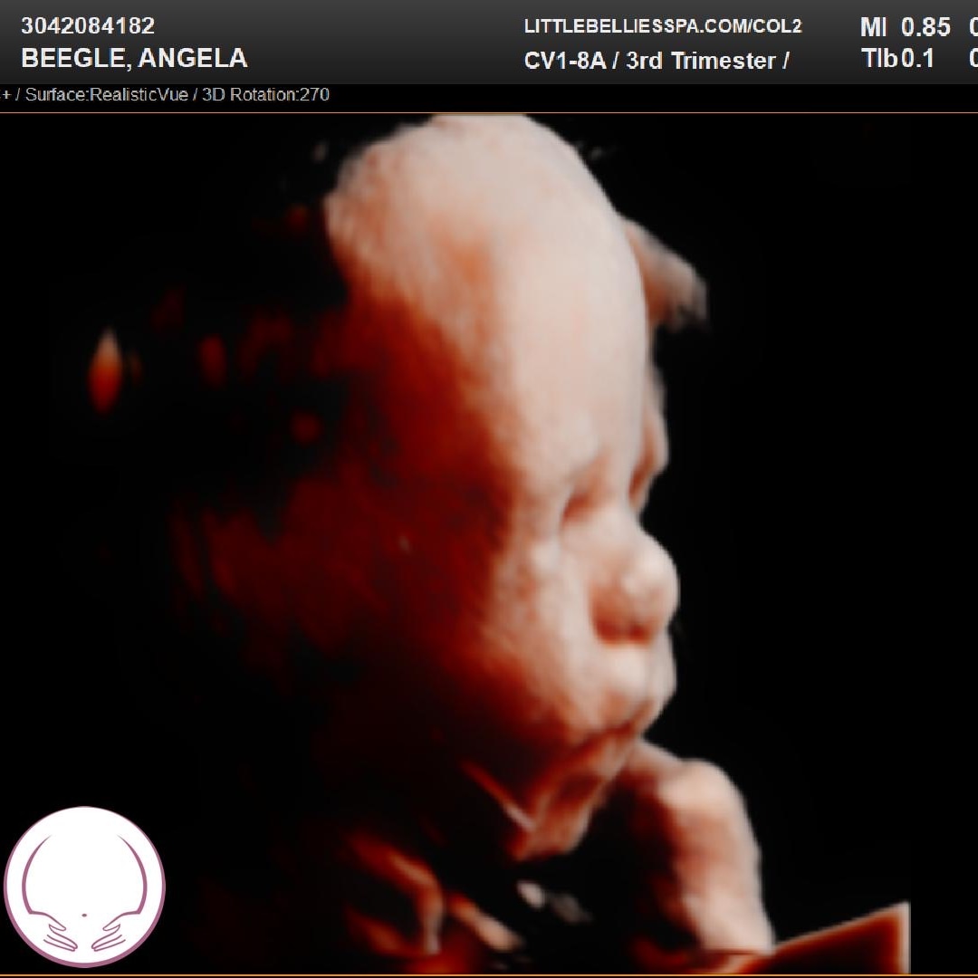 Photo shared by Angela for their Babylist baby registry.
