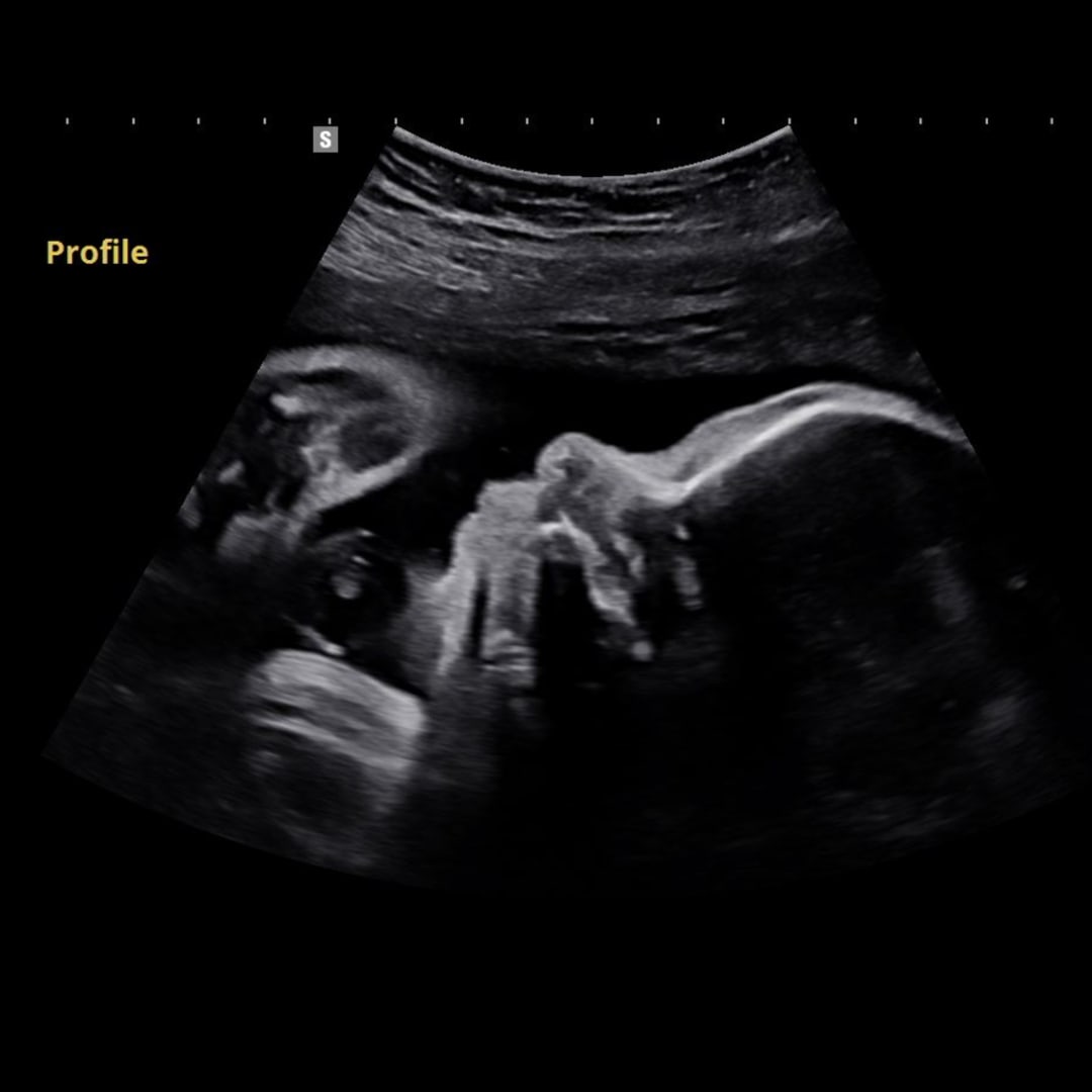 Photo shared by Marlene for their Babylist baby registry.
