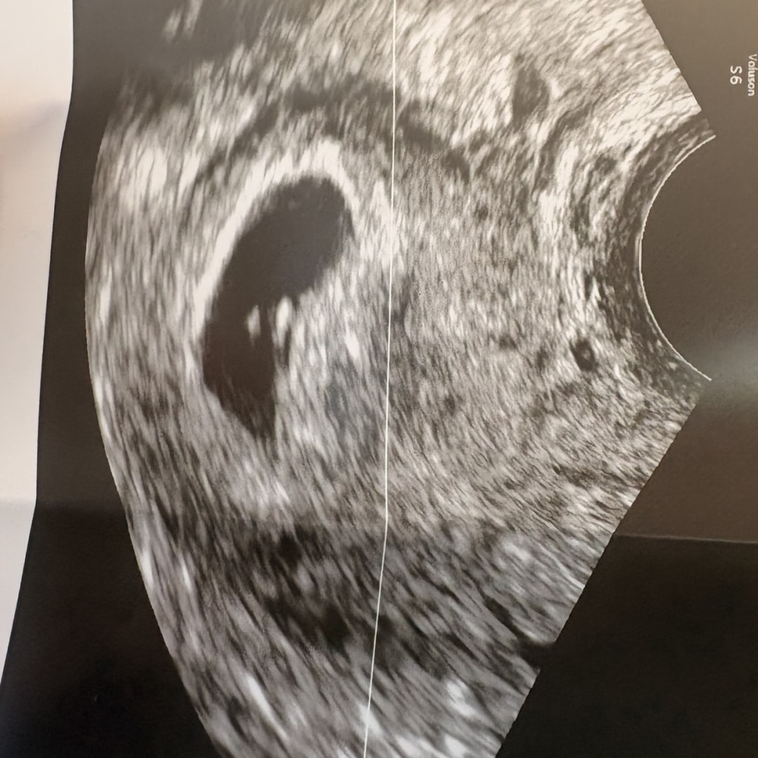 Photo shared by Dai for their Babylist baby registry.