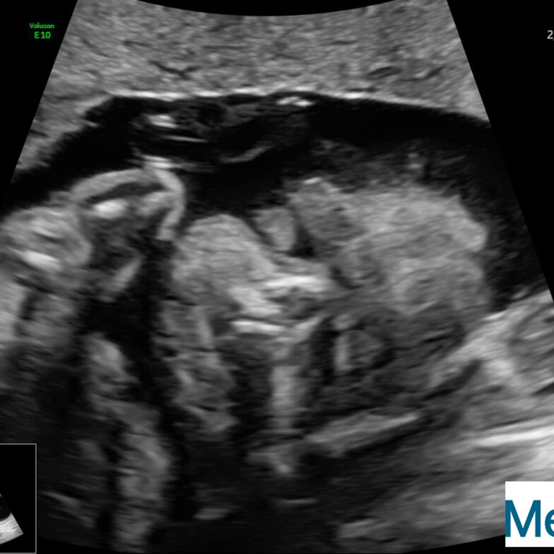 Photo shared by Edisa for their Babylist baby registry.