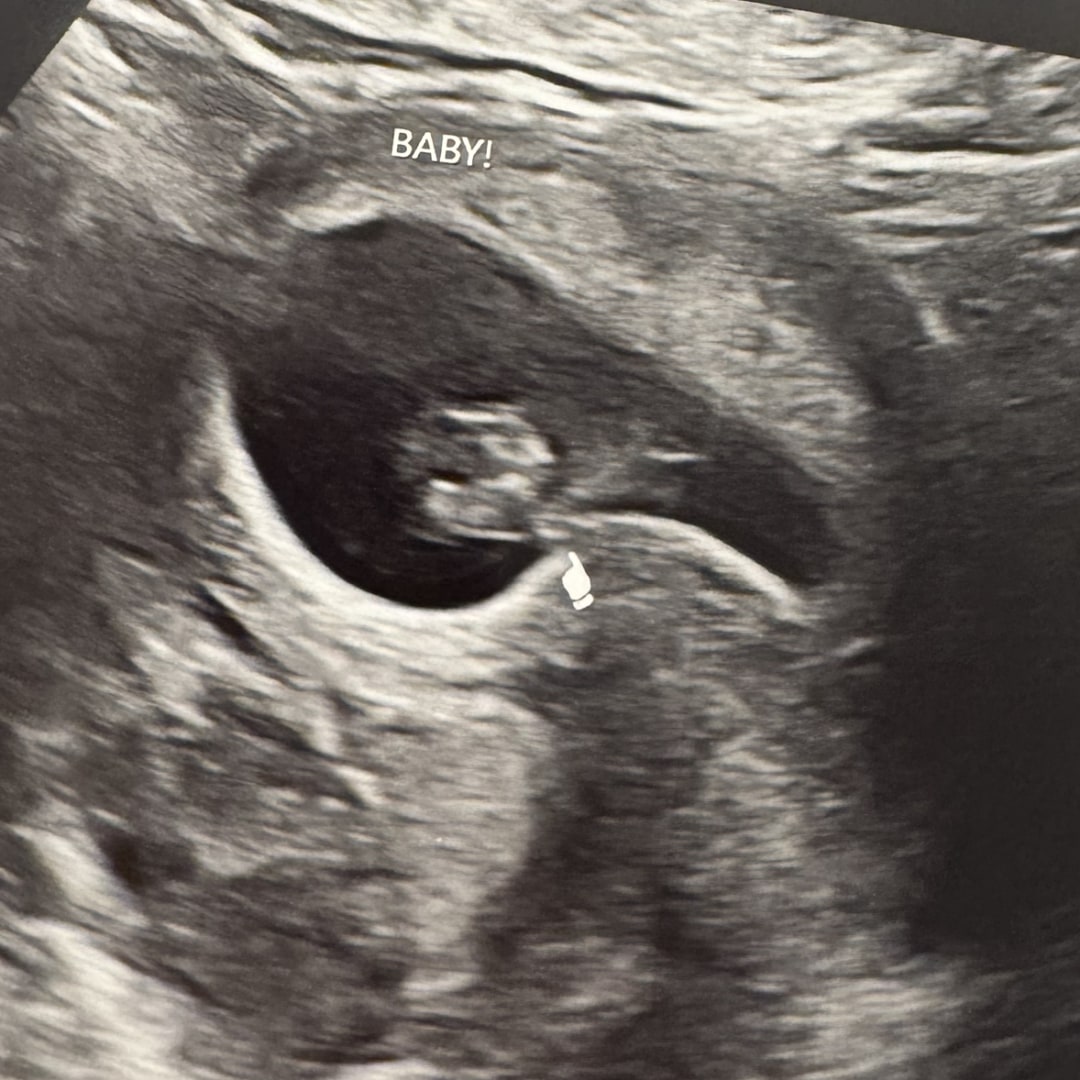 Photo shared by Mary for their Babylist baby registry.