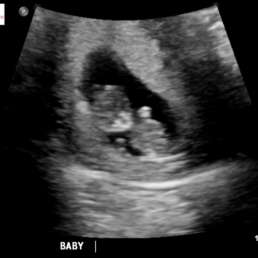 Photo shared by Candis for their Babylist baby registry.