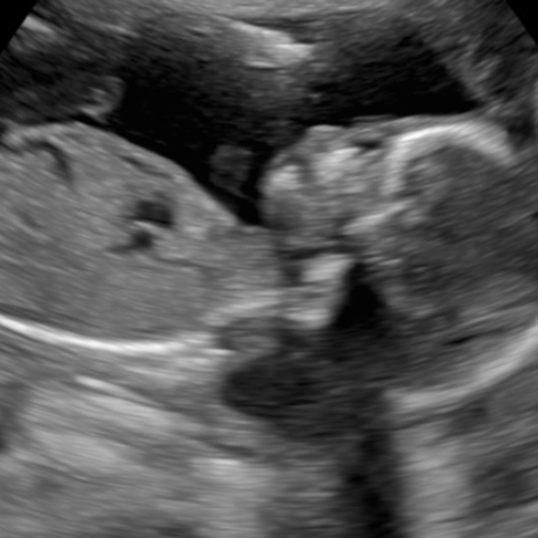 Photo shared by Heather for their Babylist baby registry.
