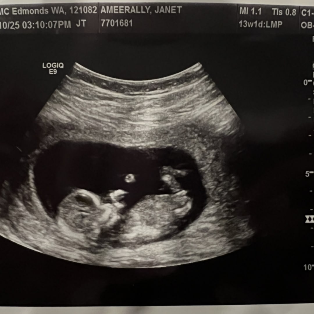 Photo shared by Janet for their Babylist baby registry.