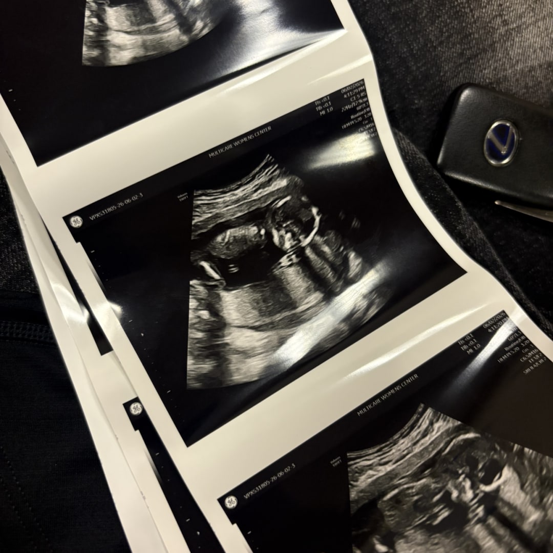 Photo shared by Valentina for their Babylist baby registry.