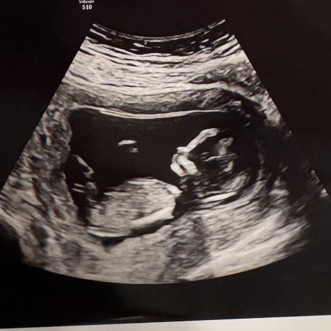 Photo shared by Mayra for their Babylist baby registry.