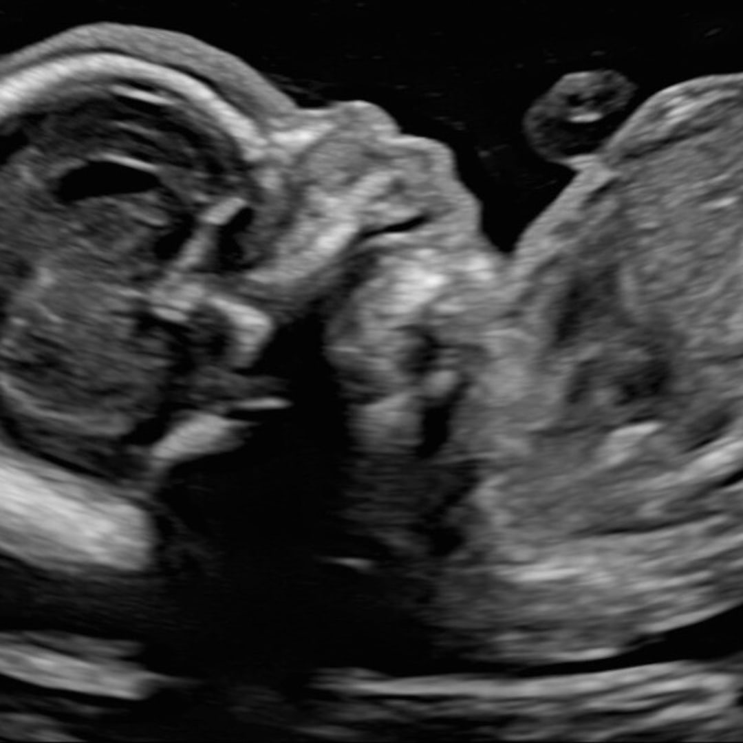 Photo shared by Amy for their Babylist baby registry.