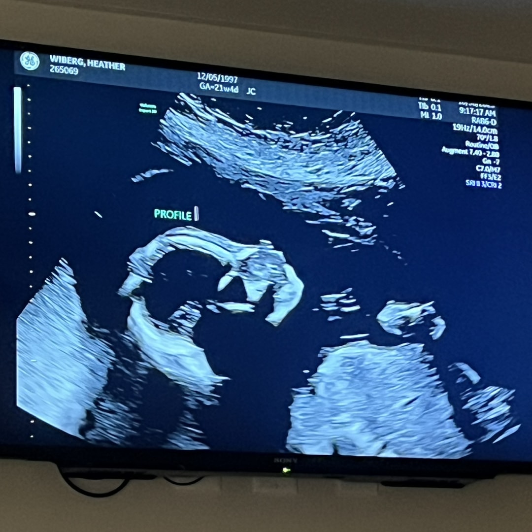 Photo shared by Heather for their Babylist baby registry.