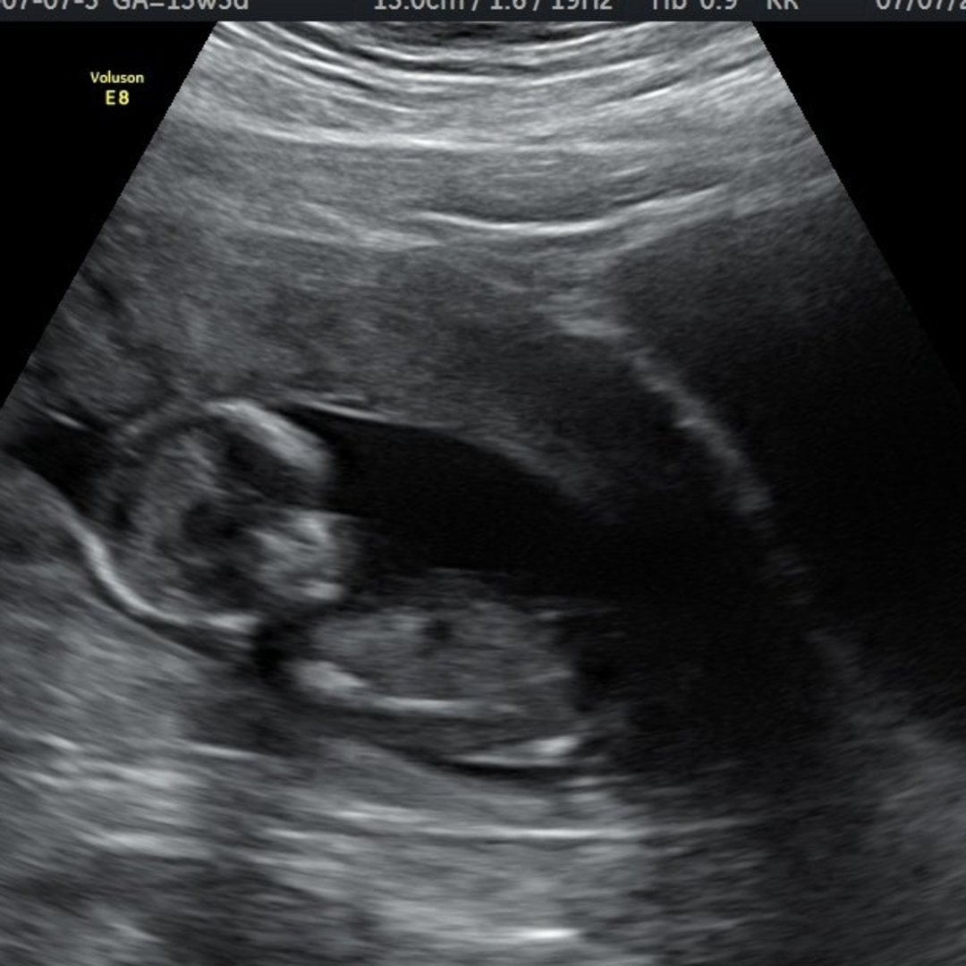 Photo shared by Sara for their Babylist baby registry.