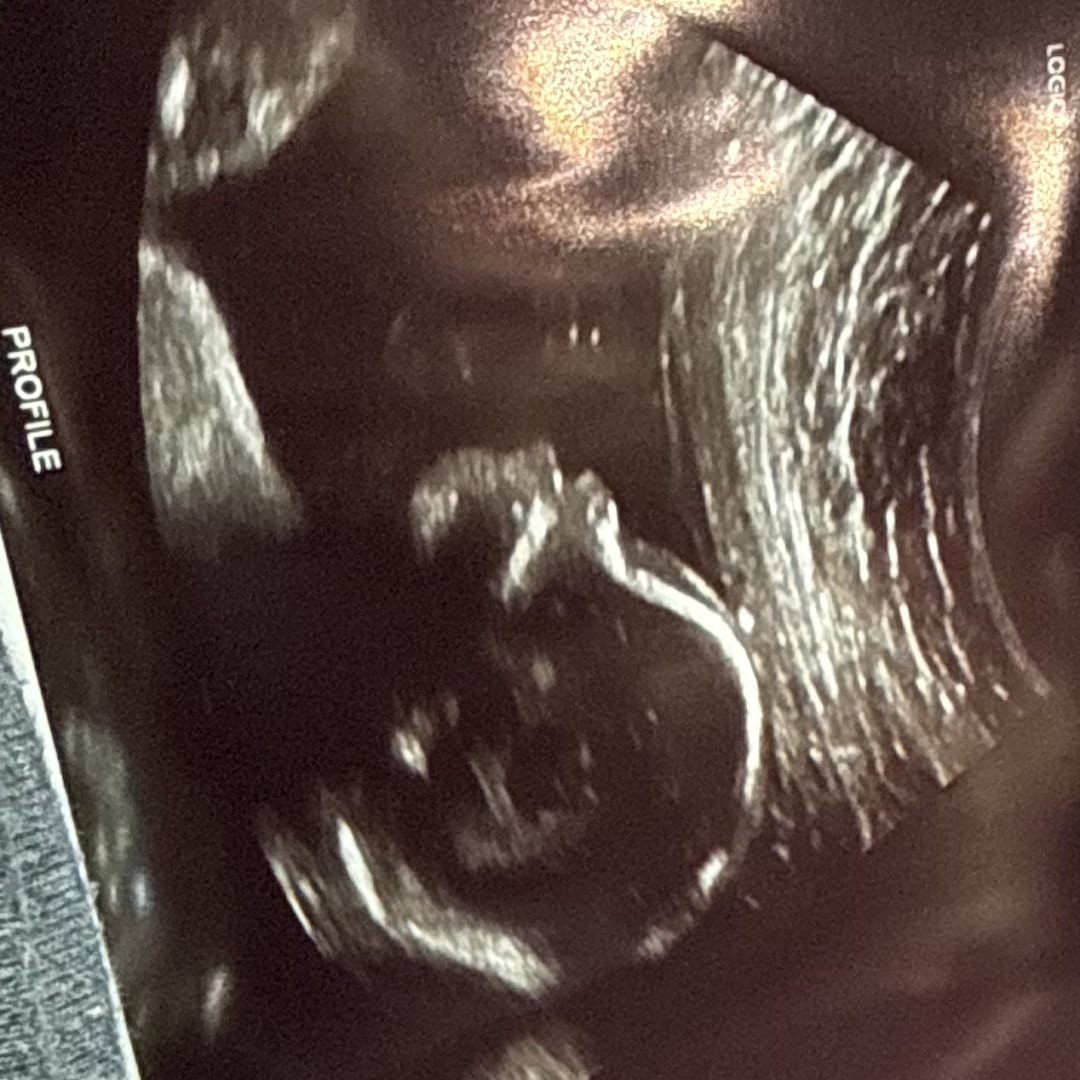 Photo shared by Jasmine for their Babylist baby registry.