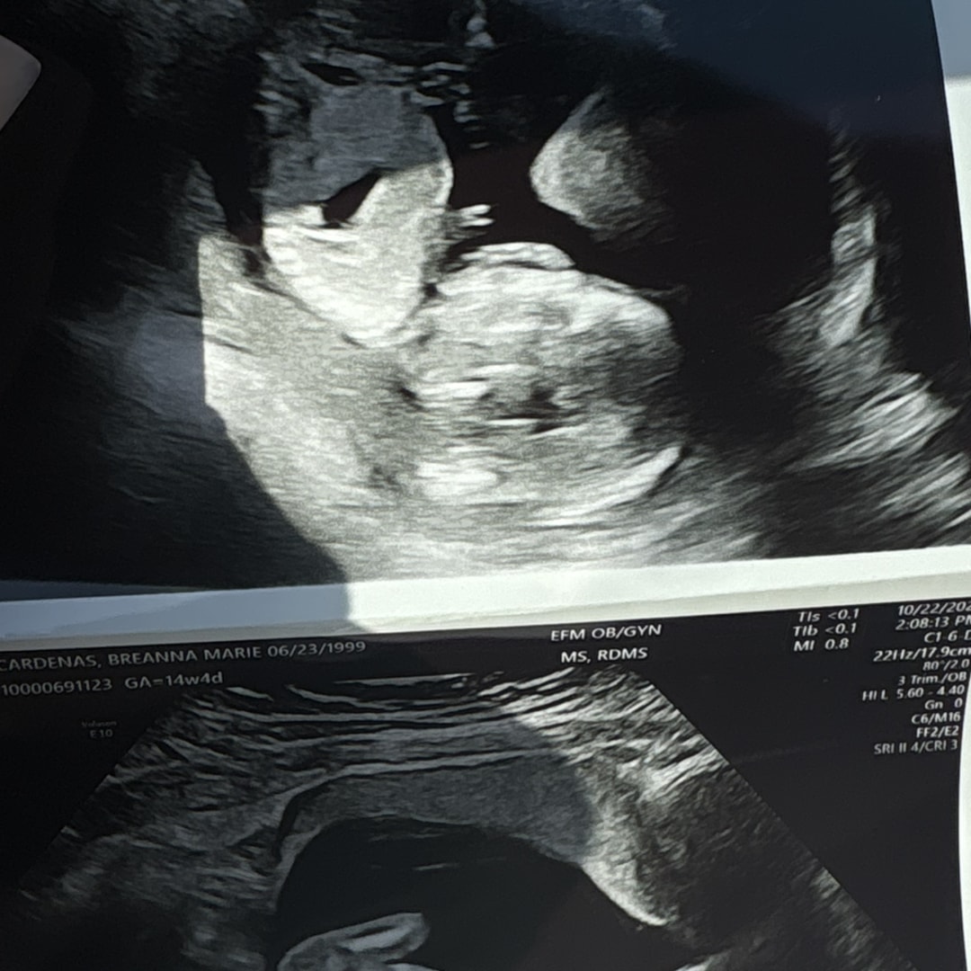 Photo shared by Breanna for their Babylist baby registry.