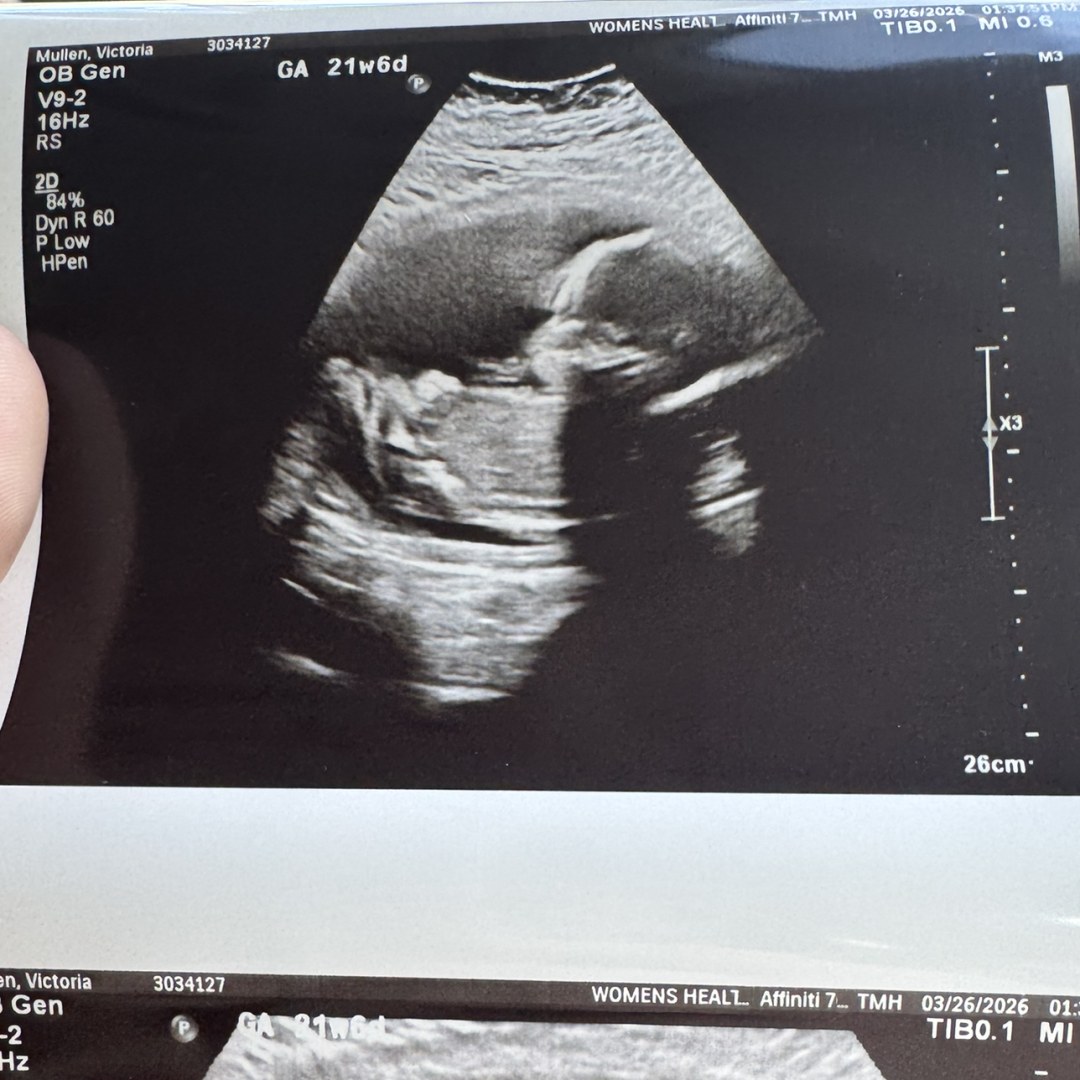 Photo shared by Victoria for their Babylist baby registry.