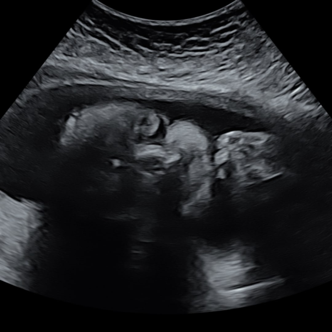 Photo shared by Alyssa for their Babylist baby registry.
