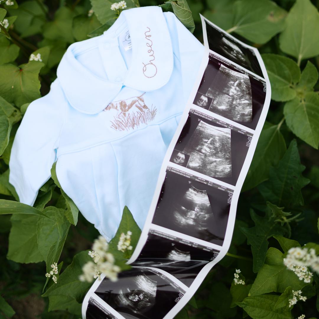 Photo shared by Madison for their Babylist baby registry.