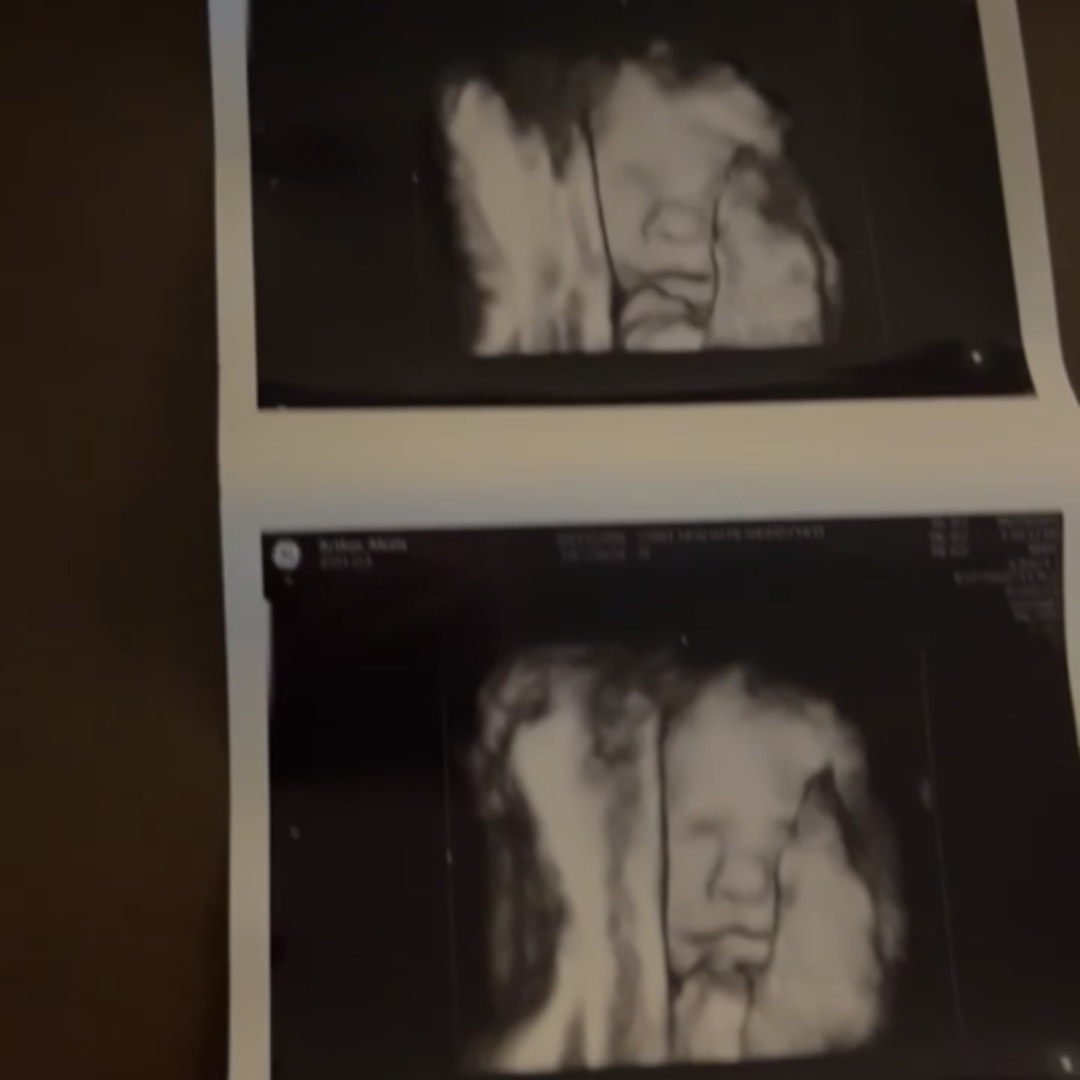 Photo shared by Lexi for their Babylist baby registry.