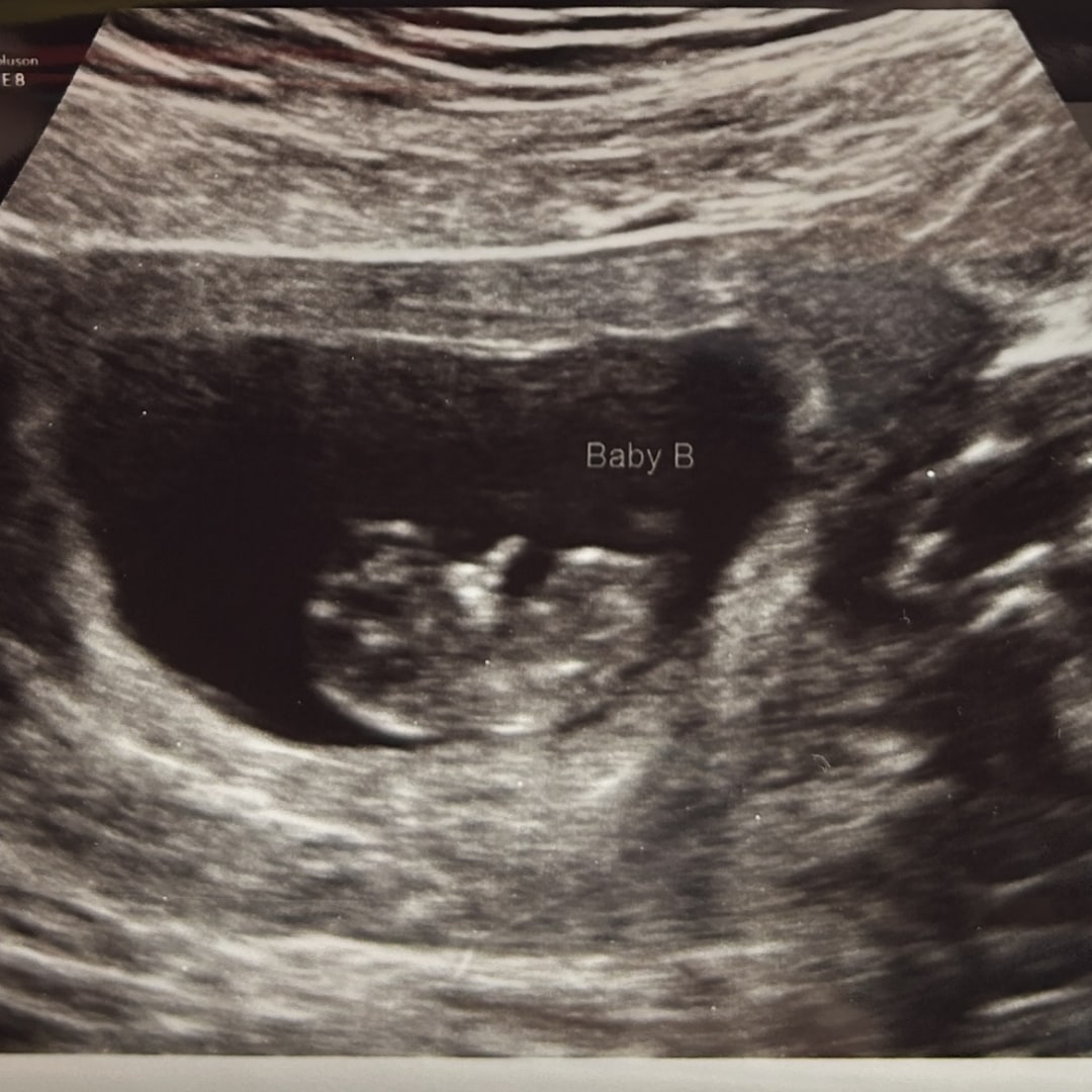 Photo shared by Rachelle for their Babylist baby registry.