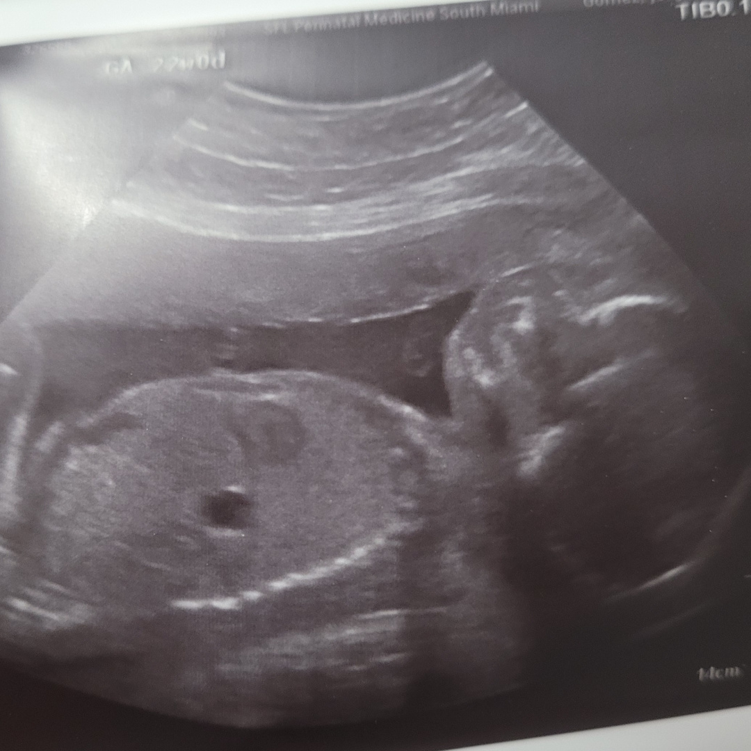 Photo shared by Lucy for their Babylist baby registry.