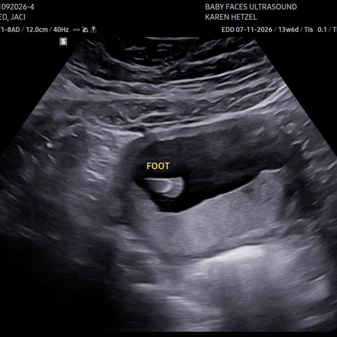 Photo shared by Jaci for their Babylist baby registry.