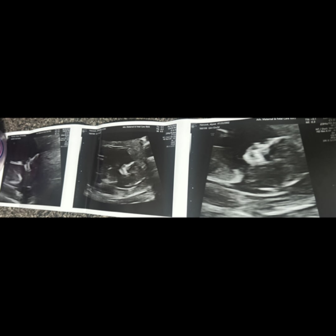 Photo shared by Alyssa for their Babylist baby registry.