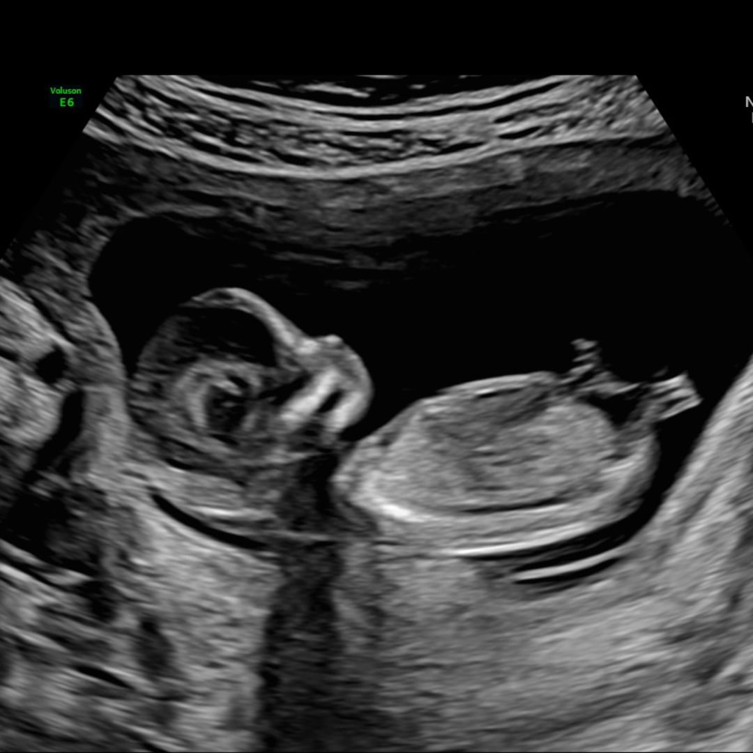 Photo shared by Simone for their Babylist baby registry.