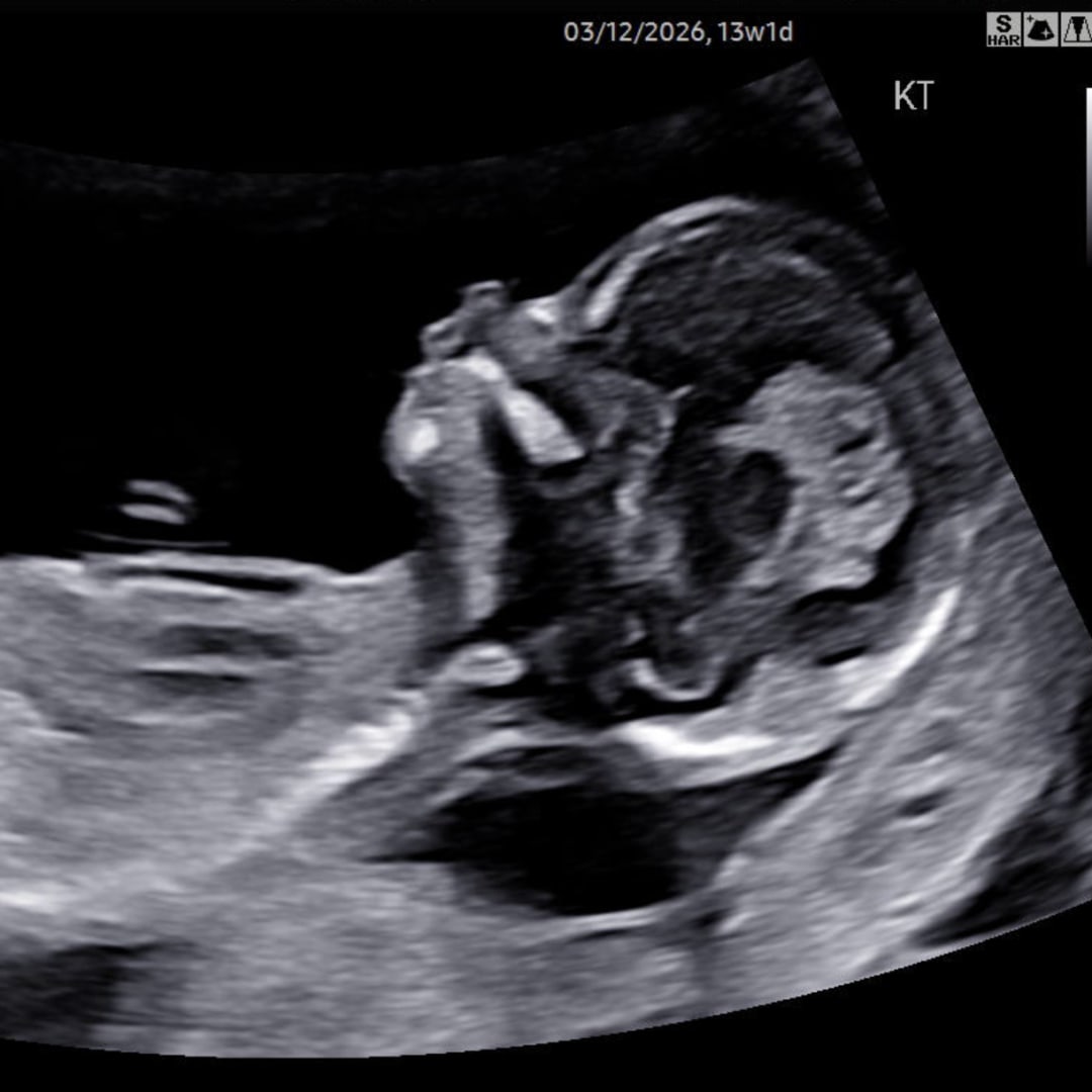 Photo shared by Kathryn for their Babylist baby registry.