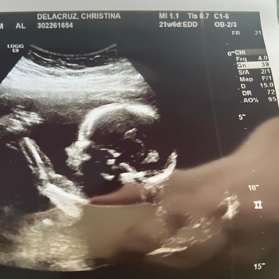 Photo shared by Christina for their Babylist baby registry.