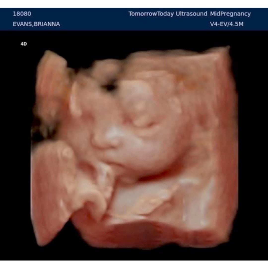 Photo shared by Brianna for their Babylist baby registry.