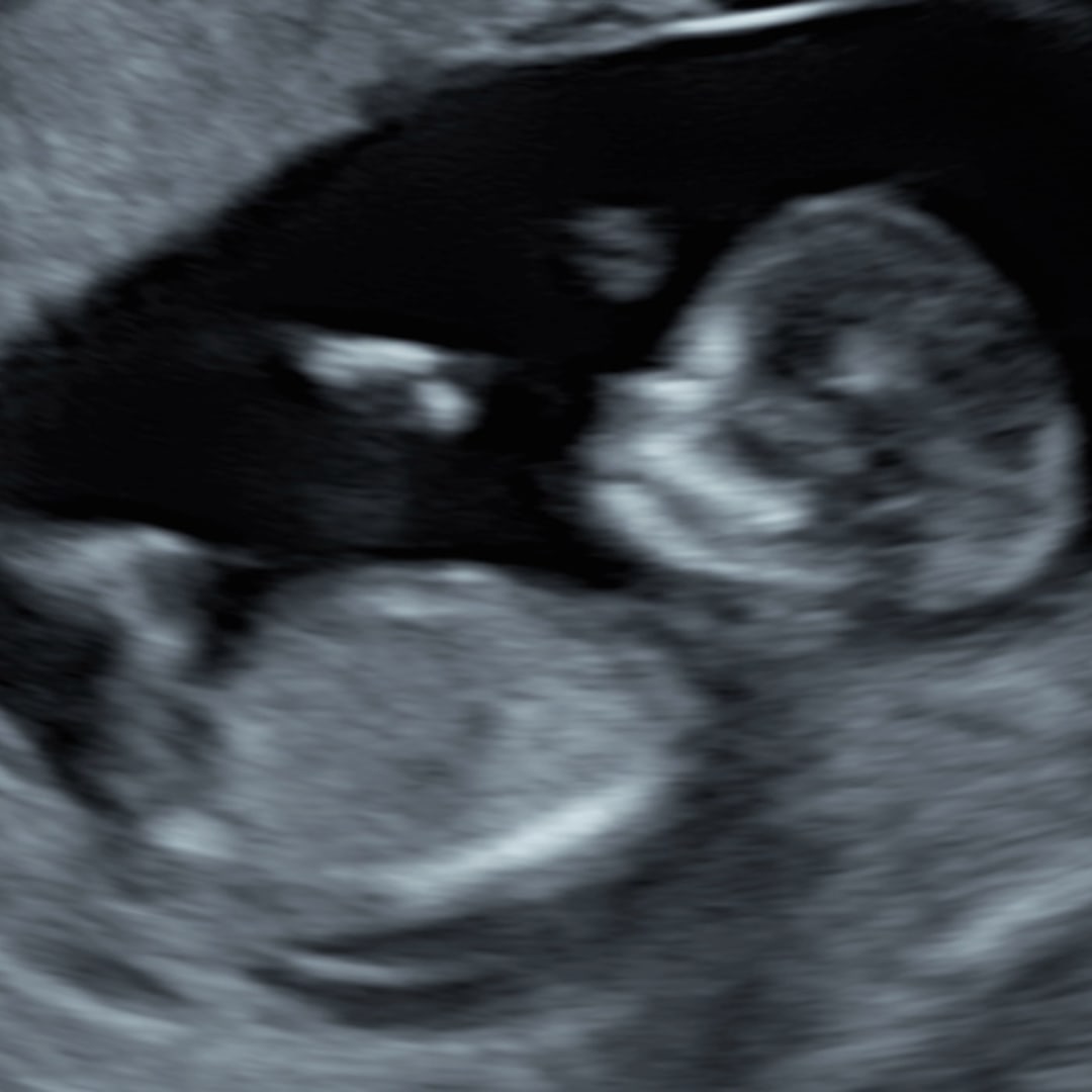 Photo shared by Mandy for their Babylist baby registry.