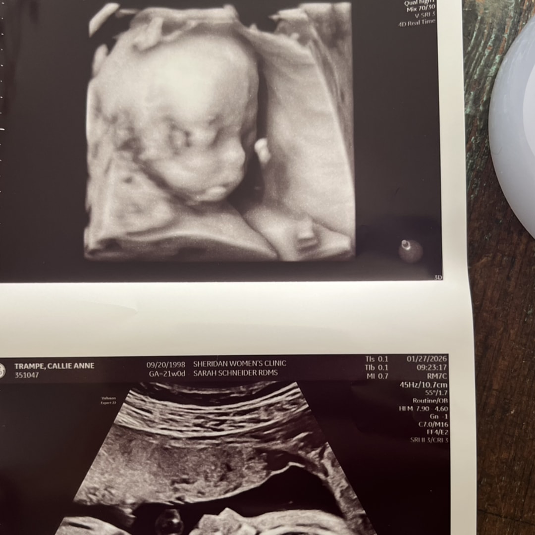 Photo shared by Callie for their Babylist baby registry.