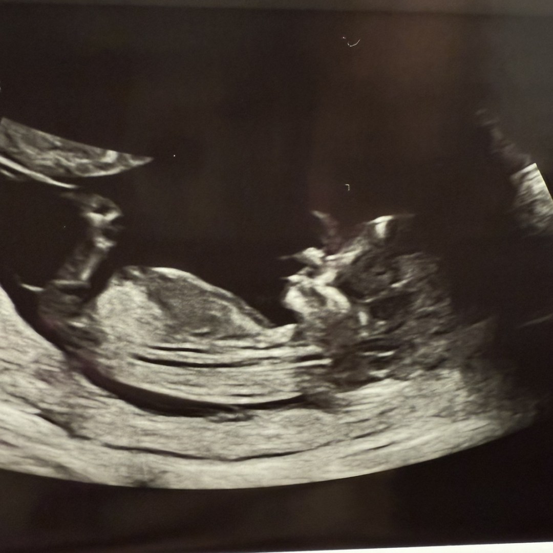 Photo shared by Haley for their Babylist baby registry.