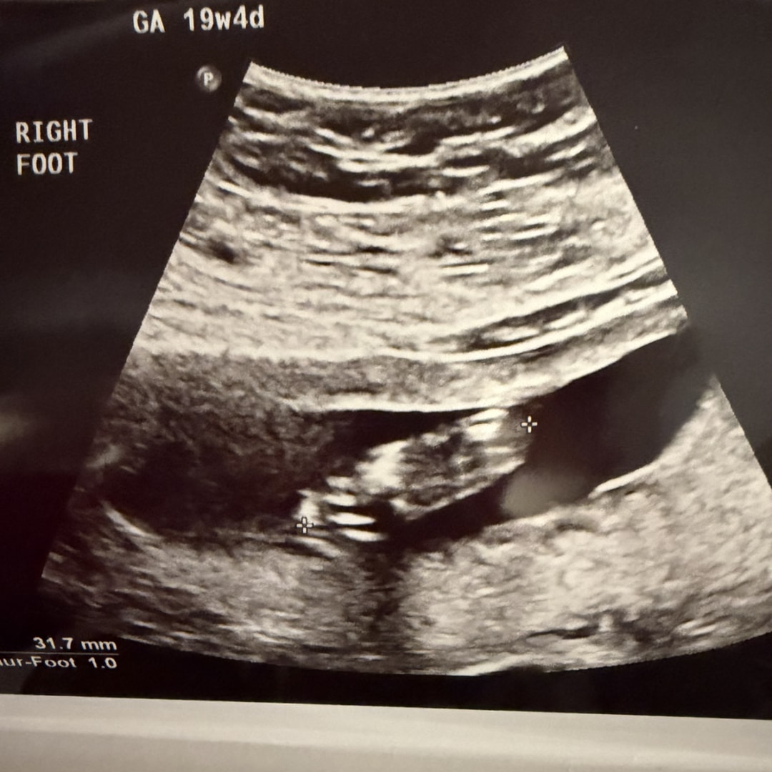 Photo shared by Ashley for their Babylist baby registry.
