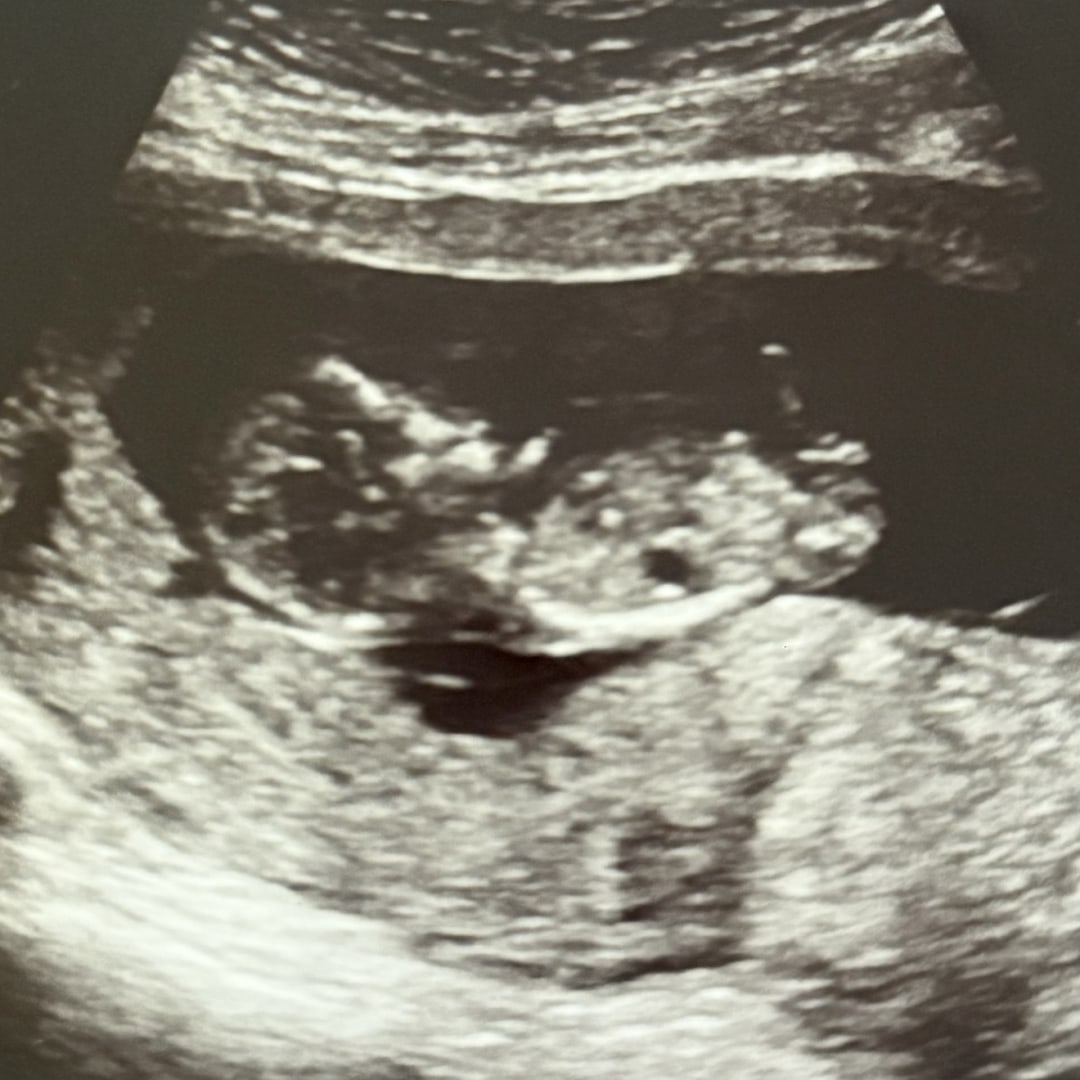 Photo shared by Desirae for their Babylist baby registry.