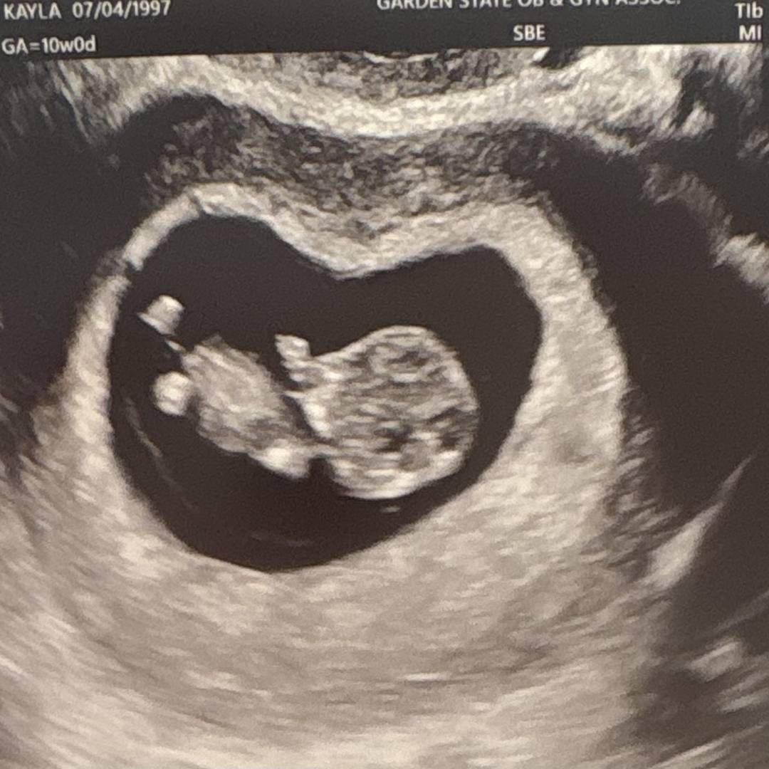 Photo shared by Kayla for their Babylist baby registry.