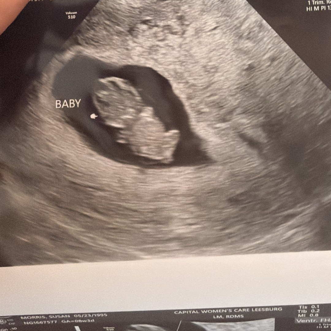 Photo shared by Billie for their Babylist baby registry.