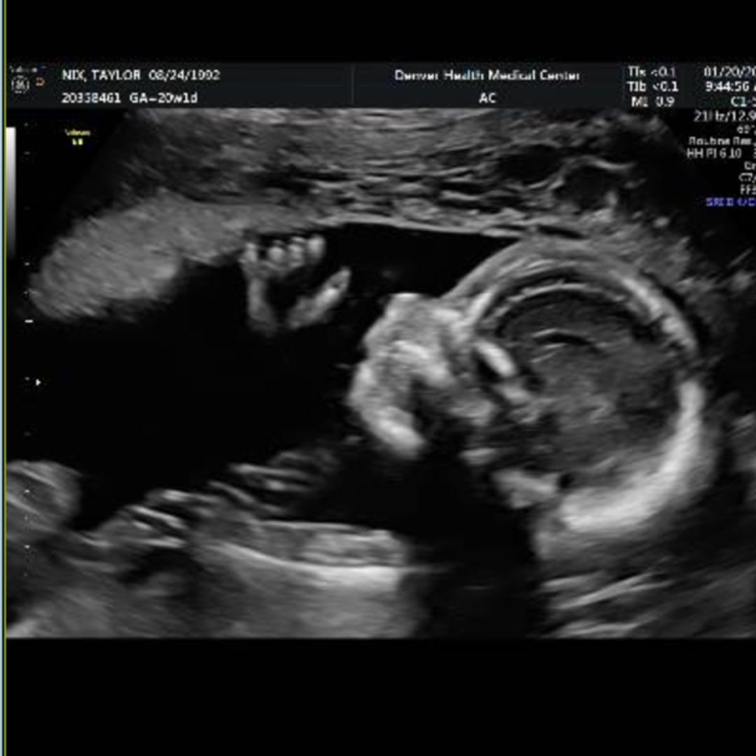 Photo shared by Taylor for their Babylist baby registry.