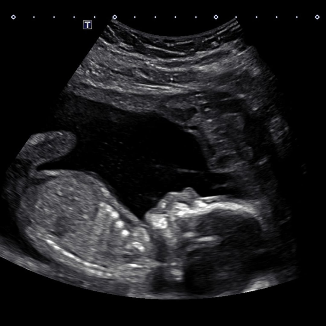 Photo shared by Maria for their Babylist baby registry.