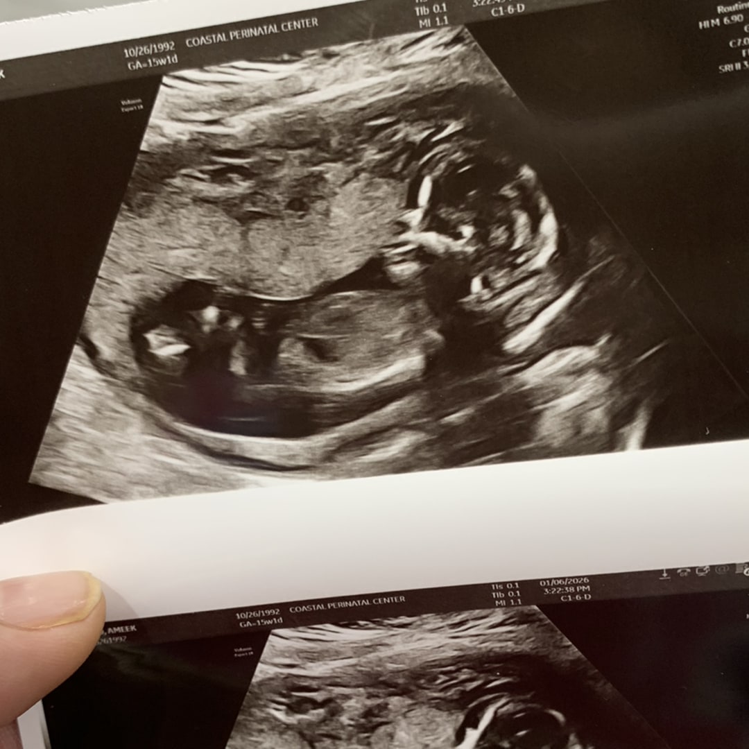 Photo shared by A’meek for their Babylist baby registry.