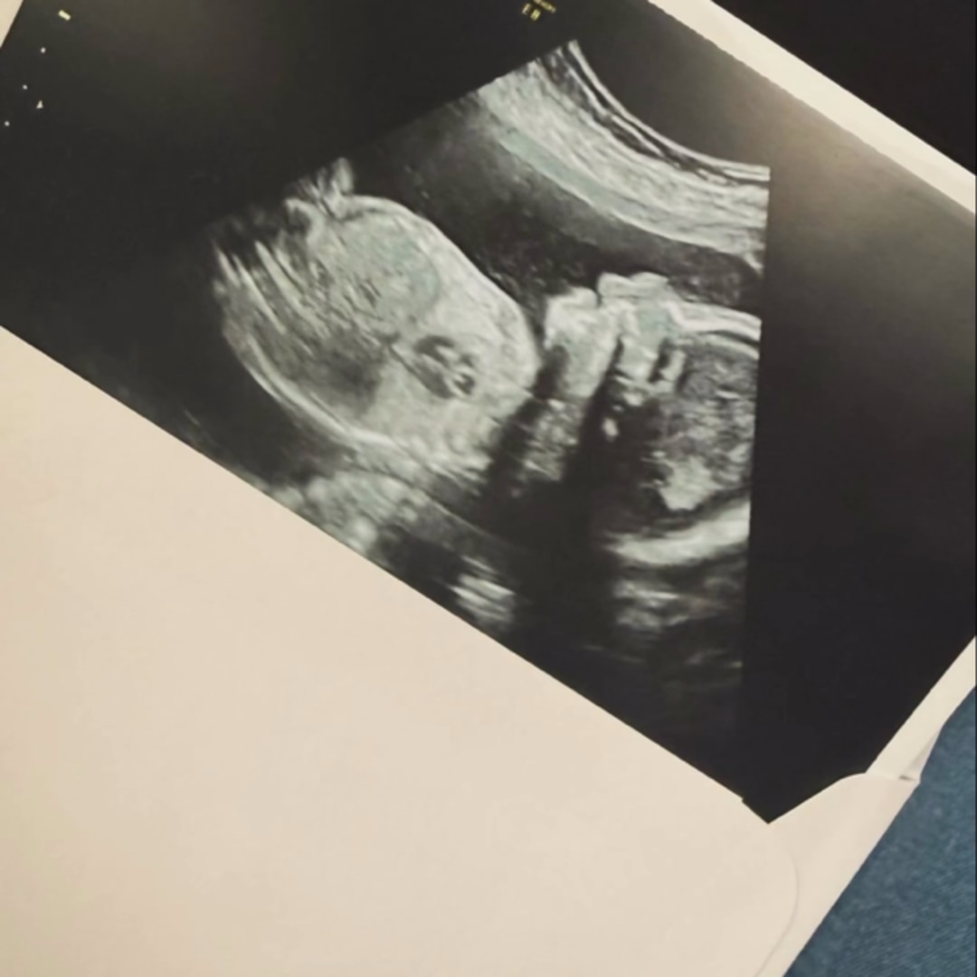 Photo shared by Alani for their Babylist baby registry.