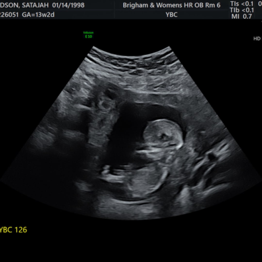 Photo shared by Satajah for their Babylist baby registry.