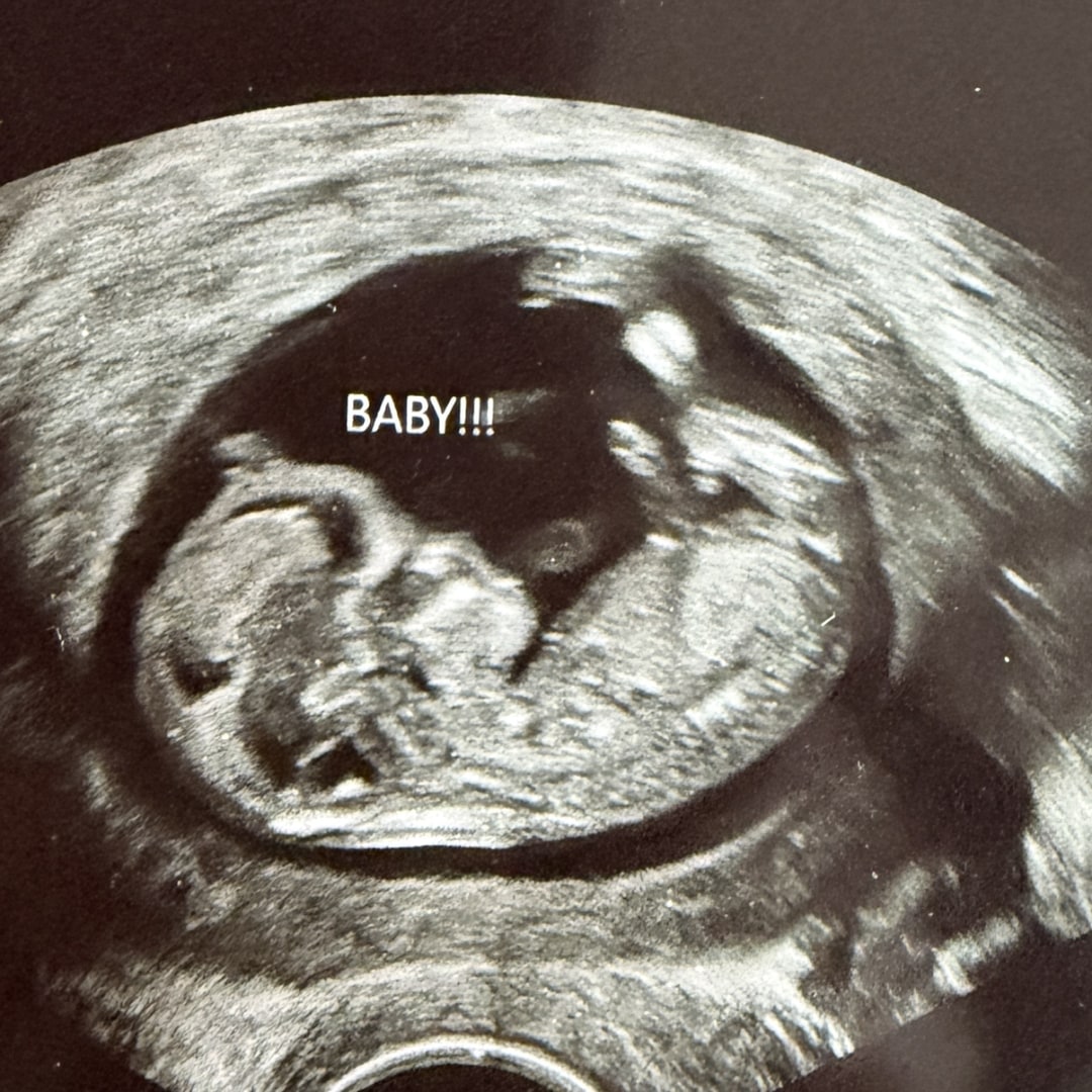 Photo shared by Madison for their Babylist baby registry.