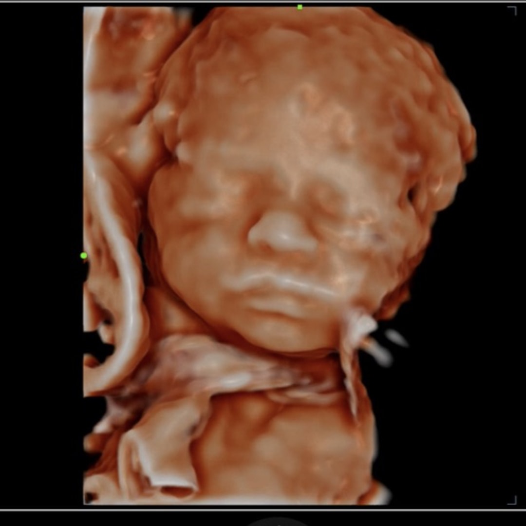 Photo shared by Lydia for their Babylist baby registry.